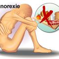 L'anorexie mentale et trouble du comprotement aliementaire