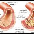 DYSFONCTION ENDOTHELIALE ET METAUX LOURDS TOXIQUES