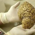 Un cerveau à un milliard d’euros !!!!