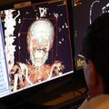 Hospital Radiologists Analyze Brooklyn Museum's Mummies and Make Discovery