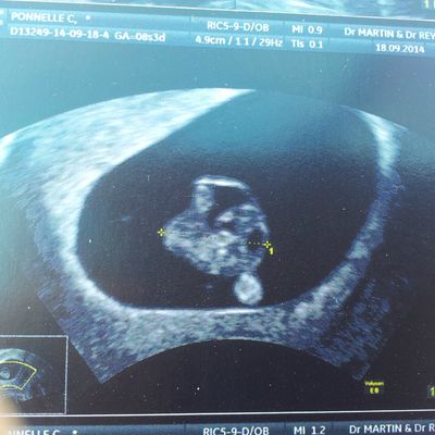 Mardi 23 Septembre 2014 : bébé !