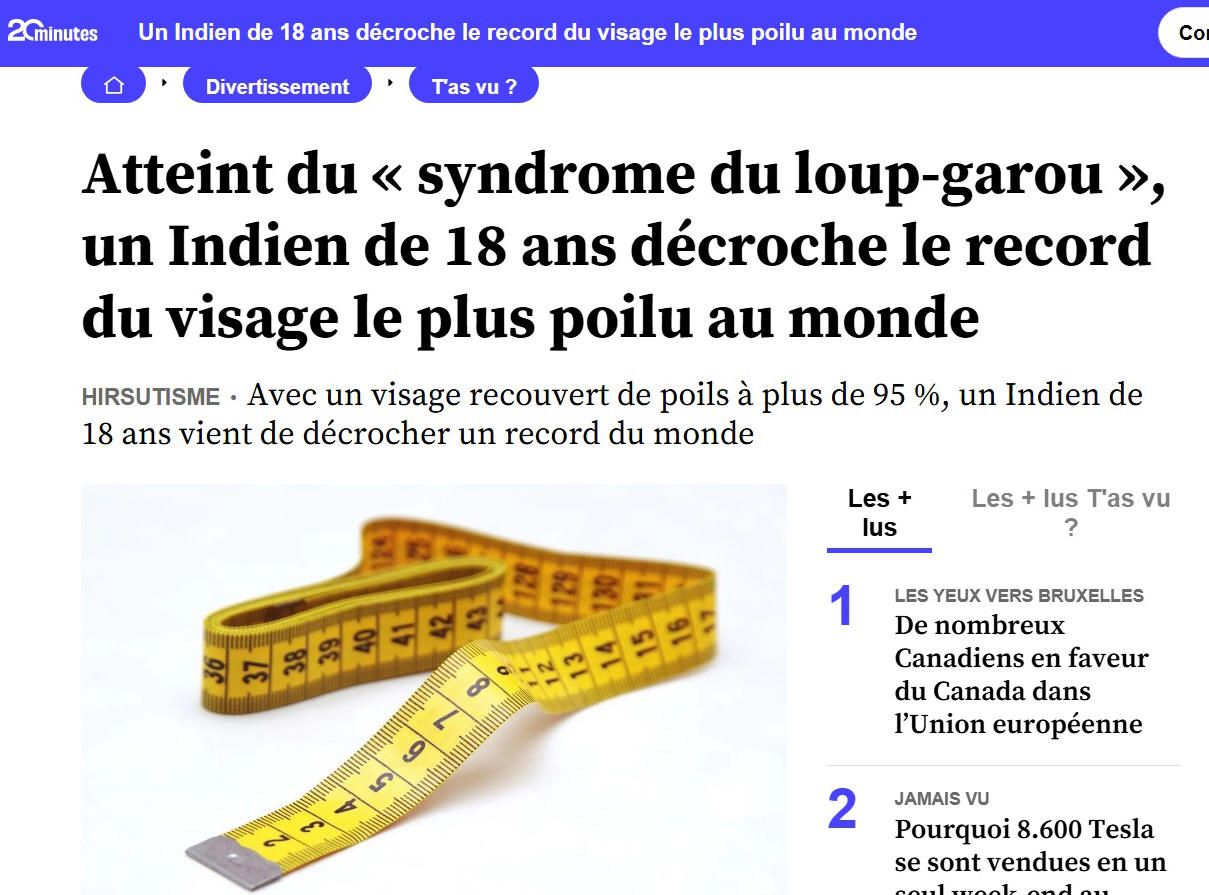 Au poil