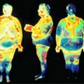 Europe : L'épidémie d'obésité infantile s'étend