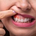 Les Normands qui ont mal aux dents veulent des dentistes formés en Normandie!