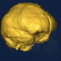 Reconstitution 3D d'un cerveau d'Homo Sapiens