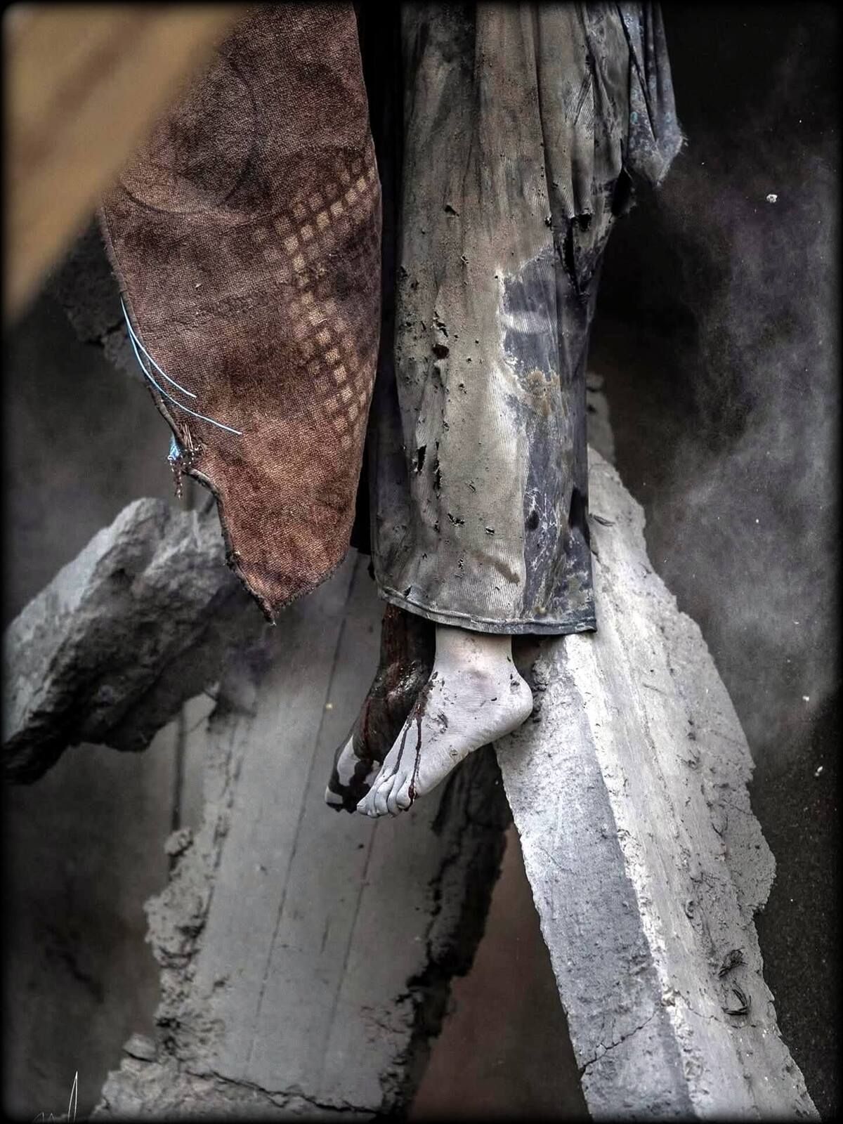 Dr. EZZIDEEN, GAZA, GENOCIDE, HORREUR, MASSACRE, NETANYAHU, SADISME, FOLIE, BOUCHER, TORTURE, ISRAEL