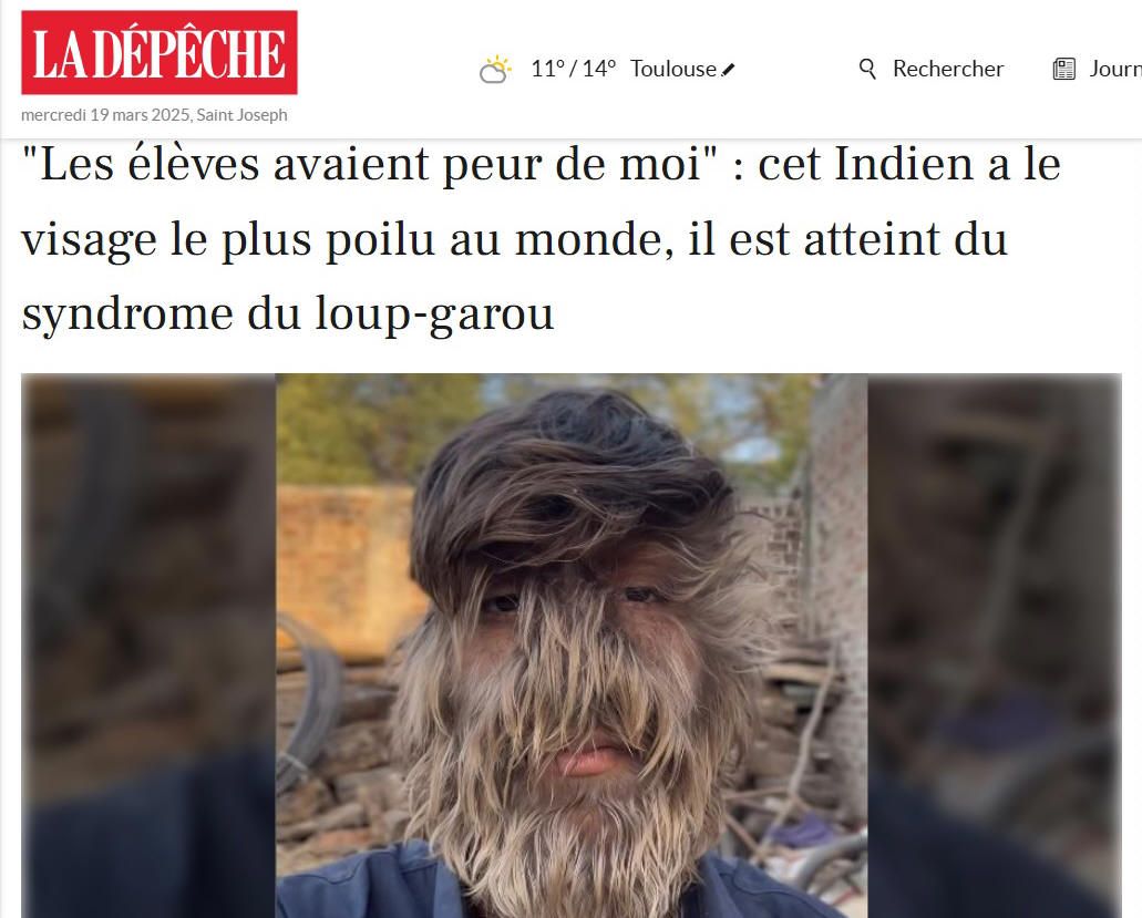 Au poil