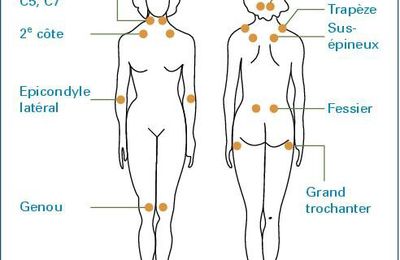 La Fibromyalgie c'est quoi ? 