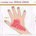 Brûlure d'ortie / Petit bobo du quotidien / Fleur de Bach : Crème Rescue