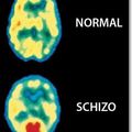 Déficits de mémoire des schizophrènes et personnes âgées