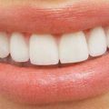 Comment blanchir ses dents ?